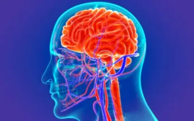 Тархины цусан хангамж буурах, шалтгаан, шинж тэмдэг, эмчилгээ 2023
